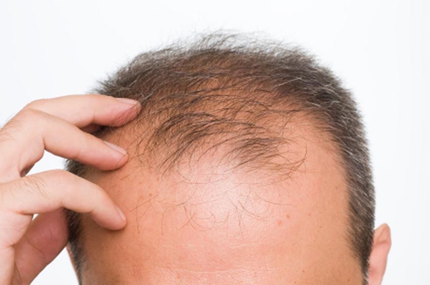 состав шампуня алерана от выпадения волос