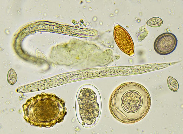 паразиты под микроскопом