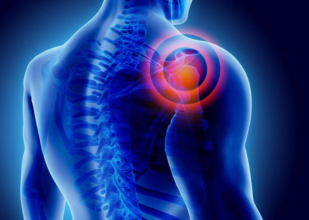 Источник боли в плечевом суставе
